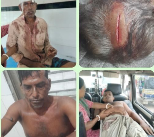 বোয়ালমারীতে বসত বাড়িতে হামলা!  বাধা দেওয়ায় খুনের উদ্দেশ্য কয়েকজনকে কুপিয়ে রক্তাক্ত জখম 